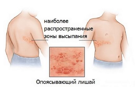 patch-uri solzoase roșii pe cauzele corpului