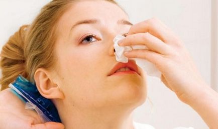 Sangerarea din nas cum să oprească cauzele de epistaxis la adulți