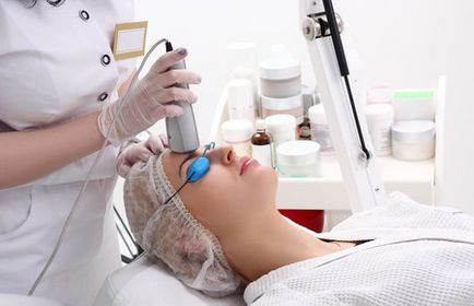 Laser comentarii acnee tratament, descrierea procedurii
