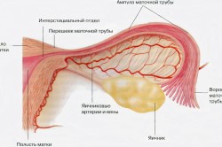 remedii populare gidrosalpinksa Tratamentul 1