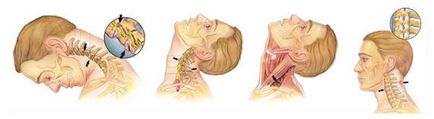 Tratamentul de leziuni ale mâinilor, articulații, cap, gât, spate, piept și degetele modul de a trata leziunile în