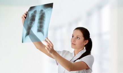 desen pulmonar întărit ceea ce înseamnă să fluoroscopie