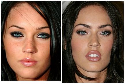 Megan fox, înainte și după fotografii și video de chirurgie plastica