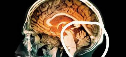 cerebel creier (mic creier) este responsabil pentru coordonarea mișcărilor