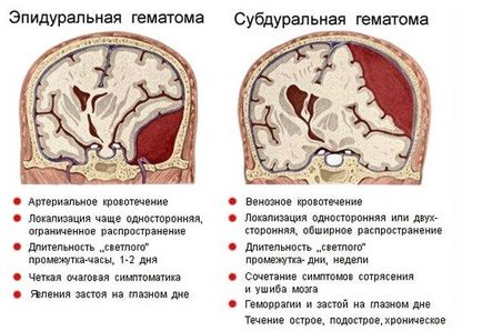 creier nou-nascuti neurosonography (grudnichka) ceea ce este, de până la ce vârstă