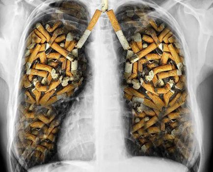 Nicotina - aceasta este ceea ce efectul nicotinei asupra organismului