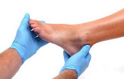 Fractura degetului mic asupra simptomelor sale picior, ce să facă, cum să se vindece repede acasă