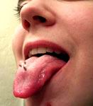 Limba piercing - ambele străpunge limba mea, ornamente, prelucrarea și efectele după o puncție