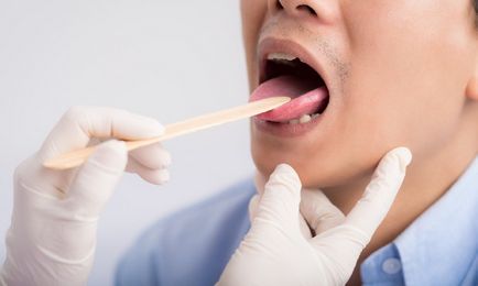 De ce doare rădăcina limbii atunci când înghițire, cauze si tratament