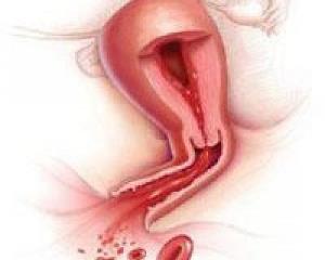 De ce col uterin sânge, ce să facă