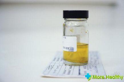 De ce este un miros puternic de urină cauze
