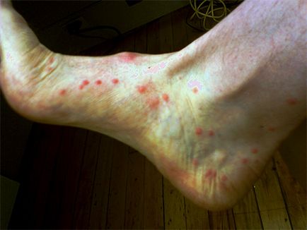 Sărituri insecte în apartament cum să depășească micile lipitori (viguros) Sărituri insecte în apartament cum să depășească micile lipitori