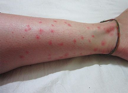 Sărituri insecte în apartament cum să depășească micile lipitori (viguros) Sărituri insecte în apartament cum să depășească micile lipitori