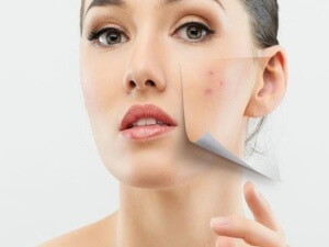 Problemă cauze ale pielii faciale și tratamente