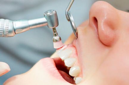 Prevenirea cariilor dentare sunt dovedite metode și mijloace