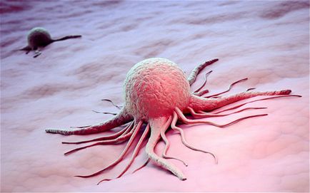 Doar despre oncologie - tratamentul cancerului, cancerul