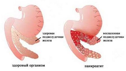 Pulsație tipurile de stomac, natura, cauzele si tratamentul
