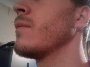 Neuniforma în creștere o barbă, ce se întâmplă dacă cresc în locuri, patch-uri de ce într-un singur loc