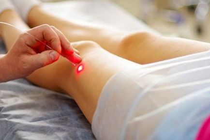 îmbinări de dezvoltare după operații de gips (după) îmbinări de dezvoltare după operațiile de gips