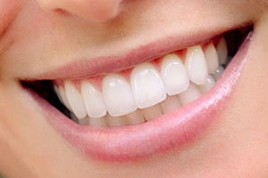 Restaurarea dinților - ceea ce este, video, căi și metode