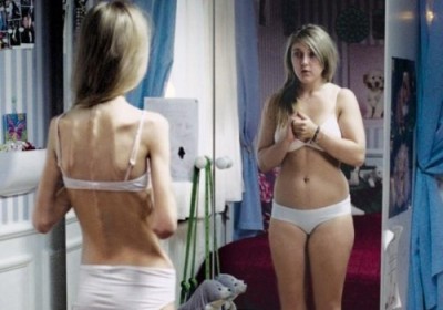 Vărsături, scădere în greutate - primul pas spre anorexie, ușor de a pierde in greutate