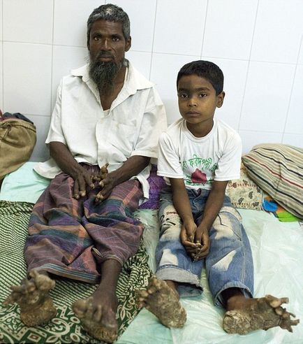 O familie, arborele de oameni o boala teribila a lovit tatăl său, unchiul și fiul
