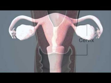 Colului uterin înainte de menstruație la atingere, arata ca și ceea ce ar trebui să fie