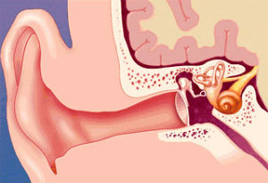 Simptomele și tratamentul otoscleroză