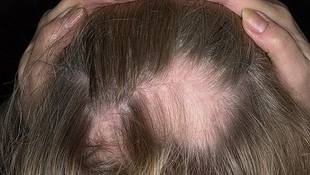 Sare de păr de la care se încadrează - retete pentru masti