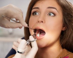 Visul despre stomatologie pentru a albeasca, elimina, sigiliu sau încorporați artificiale
