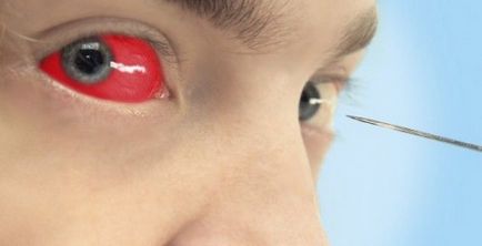 Tatuaj pe globul ocular (istorie și valori) Tatuaj pe globul ocular