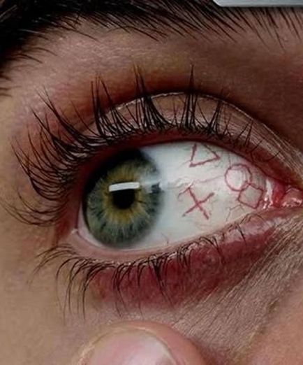 Tatuaj pe globul ocular (tatuaj pe globul ocular) Tatuaj pe globul ocular