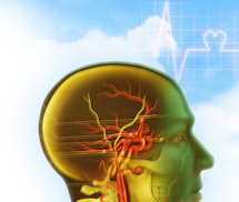 Doppler transcraniană (TCD)