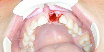 extracții dentare preturi Yekaterinburg, comentarii, adrese de stomatologie