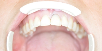 extracții dentare preturi Yekaterinburg, comentarii, adrese de stomatologie (Ekaterinburg) extracții dentare preturi Yekaterinburg, comentarii, adrese de stomatologie