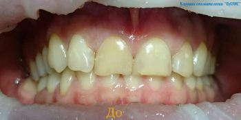 extracții dentare preturi Yekaterinburg, comentarii, adrese de stomatologie