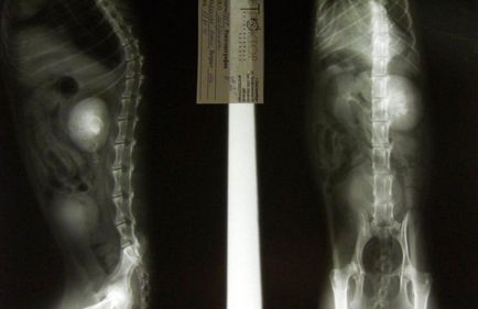 urografie excretor renale, intravenos, obiectiv turistic (urografie) Renale urografie excretor, intravenos, obiectiv turistic