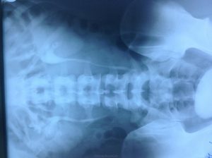 urografie excretor renale, intravenos, obiectiv turistic (urografie) Renale urografie excretor, intravenos, obiectiv turistic
