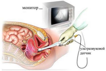 Pelvin ecografie transvaginala, abdominală, pregătire, preț