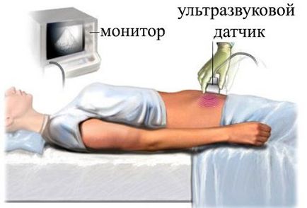 Pelvin ecografie transvaginala, abdominală, pregătire, preț