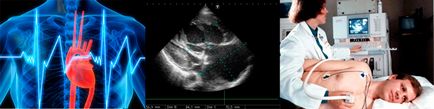 Cu ultrasunete a inimii, la un preț scăzut