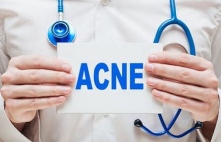Tipuri de acnee și fotografii principale clasificări