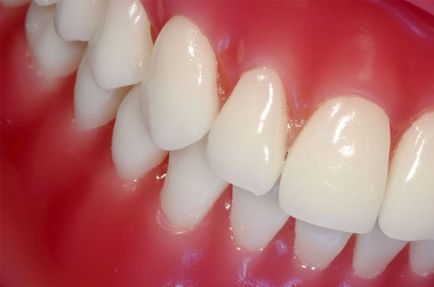 simptome de boli ale gingiilor, cauze, tratament