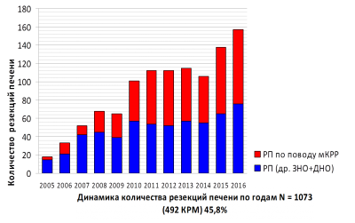 Tratamentul chirurgical al tumorilor hepatice în fbuz „Volga circumferentiala Centrul Medical Federal