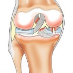 Lichidul din cauzele articulația genunchiului și tratamentul genunchiului