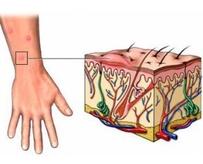Pruritul a pielii corpului cauze si tratament