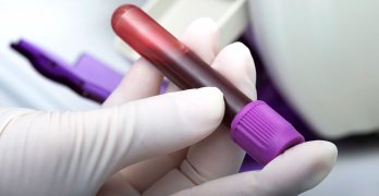 În analiza leucocitele sanguine a crescut