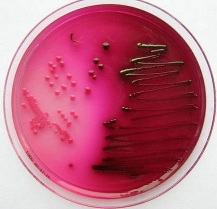 Tratamentul Escherichia coli
