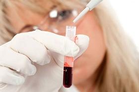 În analiza leucocitele sanguine a crescut
