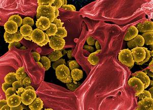 Staphylococcus aureus ce este